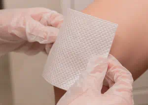 Burn bandages discount